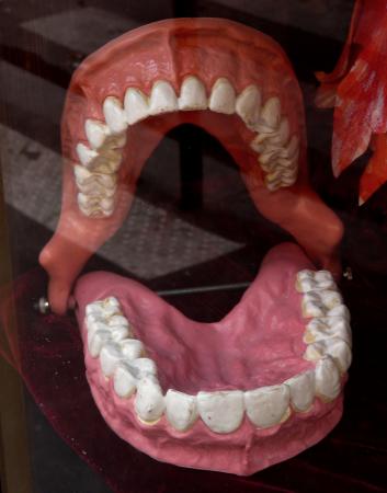 Je veux crier Ô mon dentier
